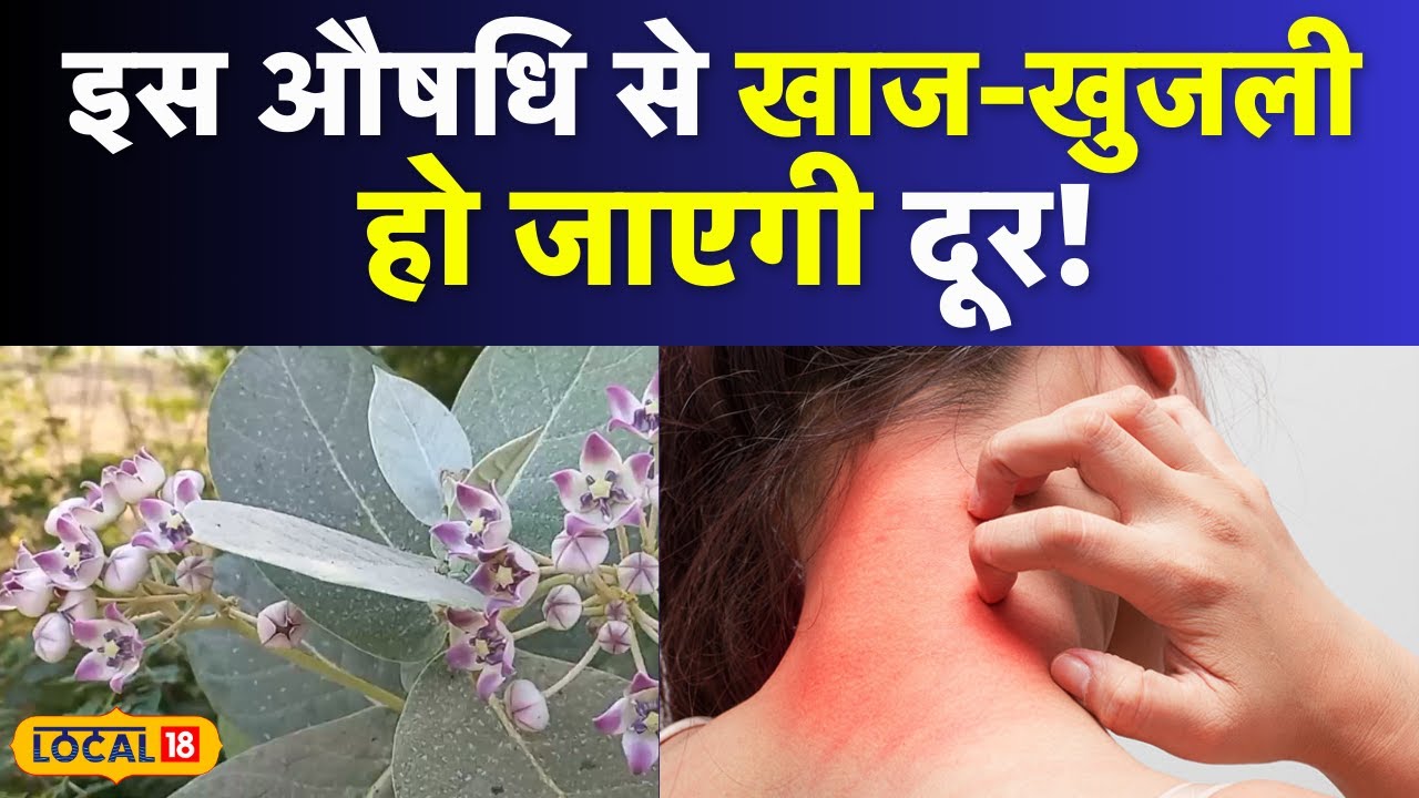 Health News : इस पौधा से चेहरे की झुर्रियों होंगी जड़ से समाप्त, जानिए इसका इस्तेमाल | #Local18