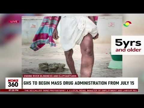 Ending river blindness: Ghana Health Service to begin mass drug administration on July 15