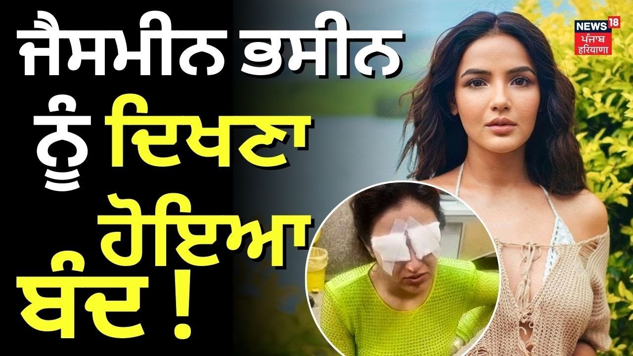 Jasmin Bhasin ਨੂੰ ਦਿਖਣਾ ਹੋਇਆ ਬੰਦ! | Jasmin Bhasin Sufferes Corneal Damage | N18V