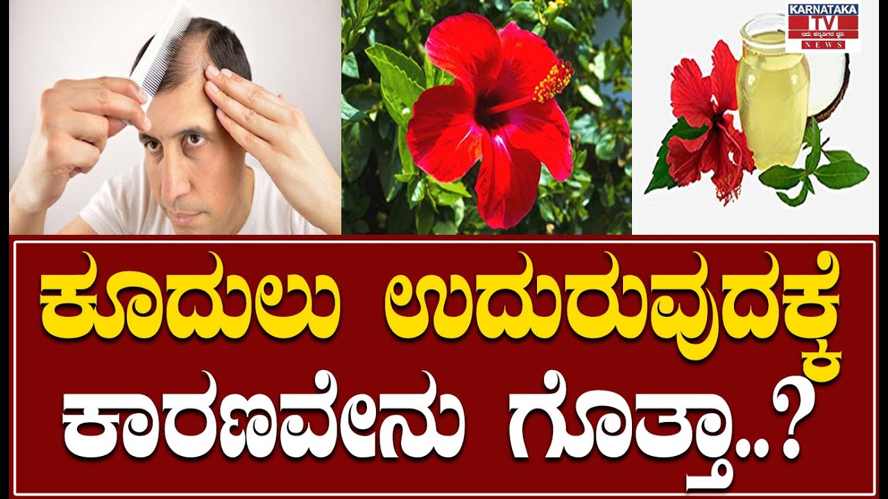 Health Tips : ಕೂದುಲು ಉದುರುವುದಕ್ಕೆ ಕಾರಣವೇನು ಗೊತ್ತಾ ..? | Karnataka News